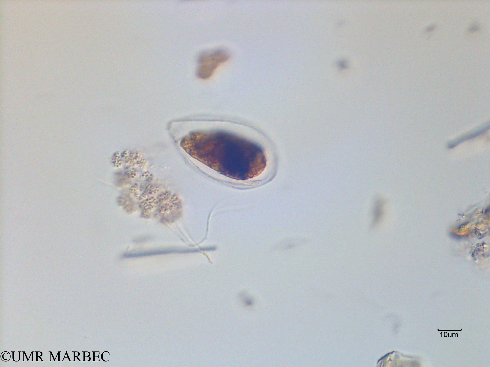 phyto/Scattered_Islands/mayotte_lagoon/SIREME May 2016/Ostreopsis sp2 (MAY11_oodinium-2).tif(copy).jpg